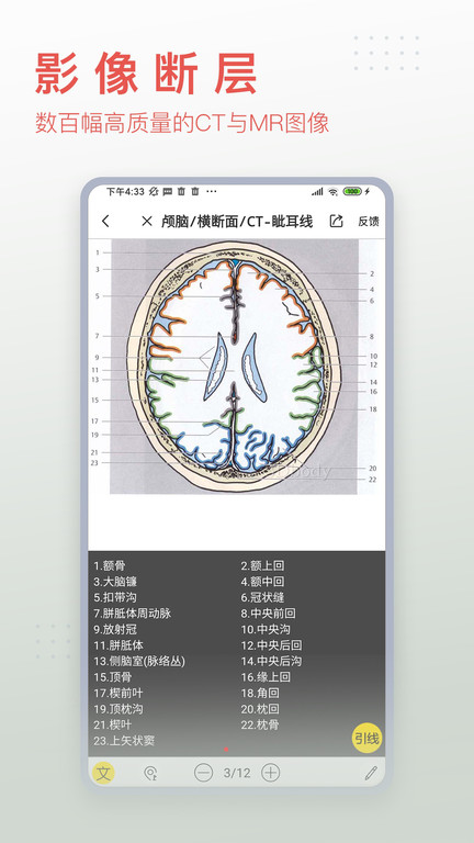 人体解剖3d软件app下载